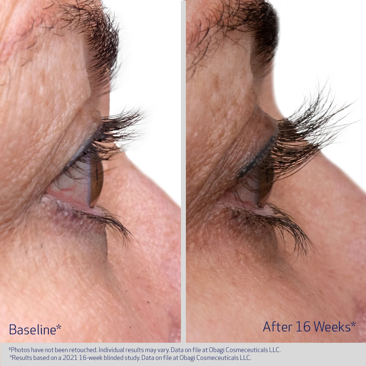 Obagi Eyelash Enhancing Serum